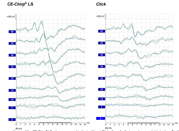 ABR waveforms using CE-Chirp vs Click, and displayed side by side. Wave five is much more prominent in the CE-Chirp tracings compared to the Click tracings.