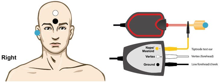 TipTrode in test ear, electrode on forehead, and ground electrode on low forehead.