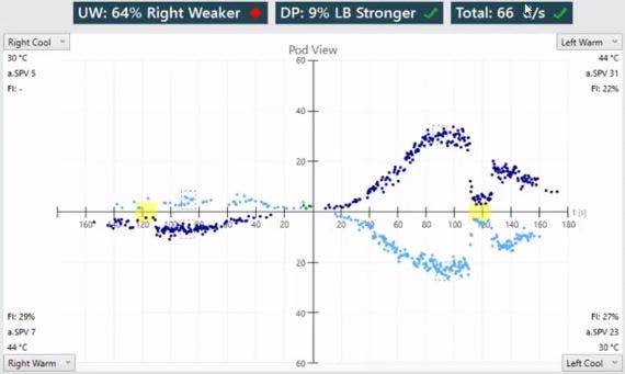 Pod view showing four quadrants for the right cool, right warm, left warm, and left cool irrigations. In each quadrant, there is a scatter plot showing data for slow phase velocity (SPV) as a function of time. The responses for the right side are much smaller than the left side. The average SPV values are as follows. Right cool equal 5. Right warm equal 7. Left warm equal 31. Left cool equal 23.