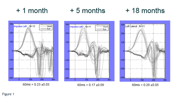 A figure with three graphs, depicting covert saccades with left impulses at various points in time.