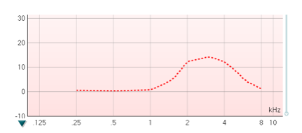 Curve with dB as a function of kHz. From 0.25 to 1 kHz, the curve is at about 0 dB. It then rises to 10 to 15 dB at 2 to 4 kHz, after which it declines to just over 0 dB at 8 kHz.
