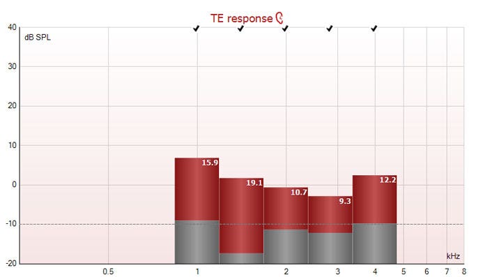 Five columns for the half-octave bands around 1, 1.5, 2, 3, and 4 kilohertz. All five bands have passed, with TEOAE response amplitudes ranging between minus 3 to plus 7 dB SPL, and signal-to-noise ratios ranging between 9.3 to 19.1.