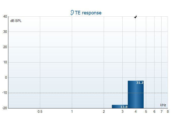 TE response graph with dB SPL as a function of kilohertz. The frequency band around 4 kilohertz is above the noise floor of minus 10 dB SPL, and is labeled with a checkmark.