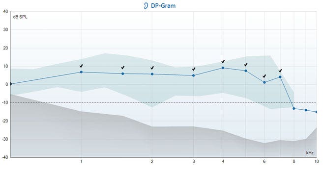 11 DP points between 1 to 10 kilohertz, with values between minus 15 to plus 9 dB SPL. The eight points from 1 to 7 kilohertz lie within a blue shaded, normative data range. The three points from 8 to 10 kilohertz are below the noise floor of minus 10 dB SPL. The grey shaded, noise amplitude range is below the noise floor from 0.5 to 10 kilohertz.