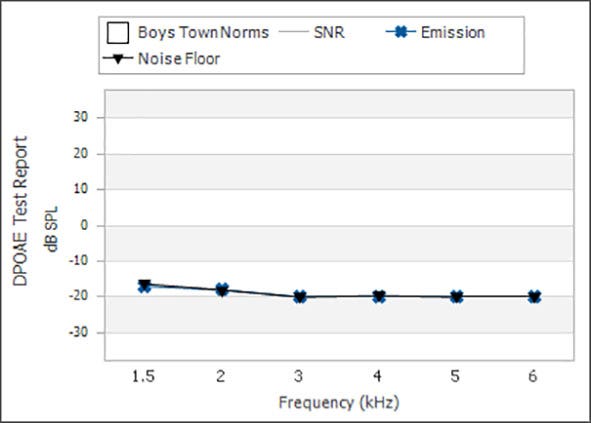 From 1.5 to 6 kilohertz, the noise floor ranges between minus 15 to minus 20 dB SPL.