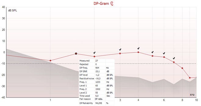 The DP point in question is well above the noise floor of minus 10 dB SPL with an SNR of 15.1. But the point has not been accepted, as it only has a reliability of 94.295%.