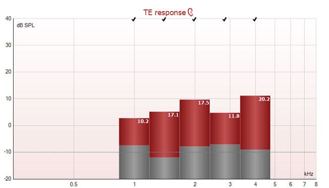 Graph with dB SPL as a function of kilohertz. The TEOAE responses range from 2 to 11 dB SPL, with signal-to-noise ratios between 10.2 to 20.2.