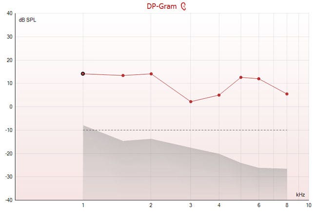 Graph with dB SPL as a function of kilohertz, titled as a DP-Gram. The noise floor is minus 10 dB SPL, with eight DP points above this level. The points range from 2 to 14 dB SPL.