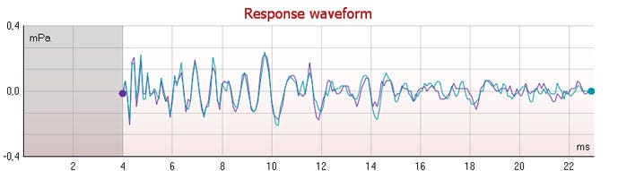 Graph with mPa as a function of milliseconds. The grey shaded area ranges from zero to 4 milliseconds. The waveform ranges from 4 to 23 milliseconds in the time domain. The mPa levels range between minus 0.2 to plus 0.2.