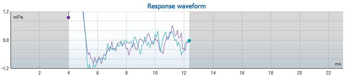 Graph with mPa as a function of milliseconds. The waveform ranges from 4 to just above 12 milliseconds in the time domain. The mPa levels vary drastically, with a very steep ascension followed by a very steep descent in the first few milliseconds.