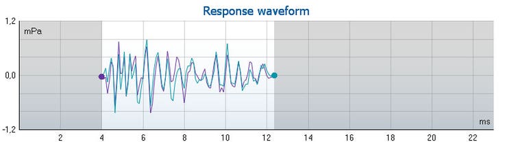 Graph with mPa as a function of milliseconds. The waveform ranges from 4 to just over 12 milliseconds in the time domain, and ranges from about minus 0.8 to plus 0.8 mPa.