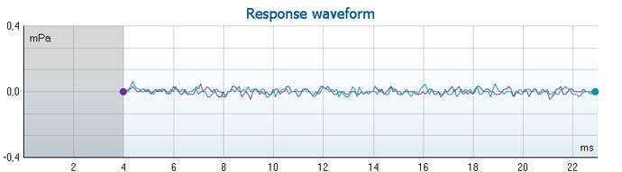 Graph with mPa as a function of milliseconds. The waveform ranges from 4 to 23 milliseconds in the time domain and sticks closely to zero mPa.