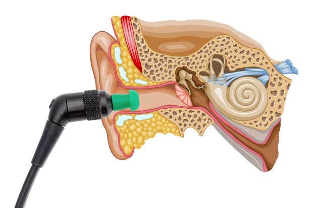 Black probe with green probe tip inserted into an ear canal. The depiction of the ear shows the pinna, ear canal, ear drum, malleus, incus, stapes, semicircular canals, cochlea, Eustachian tube, and the vestibular, facial, and auditory nerves.
