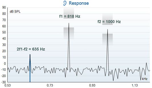 DP response graph with dB SPL as a function of kilohertz. f1 is at 818 hertz. f2 is at 1000 hertz. Thus, 2f1 minus f2 is 635 hertz.