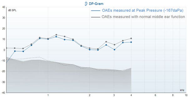 From 0.2 to 4 kilohertz, the DP points at both pressures are quite close to each other.