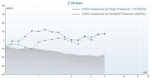 From 0.2 to 1.6 kilohertz, the DP points at peak pressure lie significantly above the DP points at ambient pressure. From 1.8 to 4 kilohertz, the DP points at both pressures are quite close to each other.