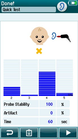 The refer results are labeled with a yellow x and have referred on four out of four at 2, 3, 4, and 5 kilohertz.