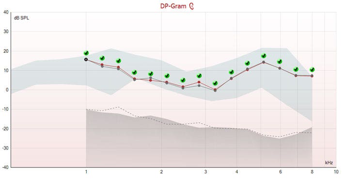 15 DP points between 1 to 8 kilohertz. Two curves are overlaid: a red one for the current test and a grey one for a previous test. The two curves are almost identical, with DP points ranging from zero to about 16 dB SPL.