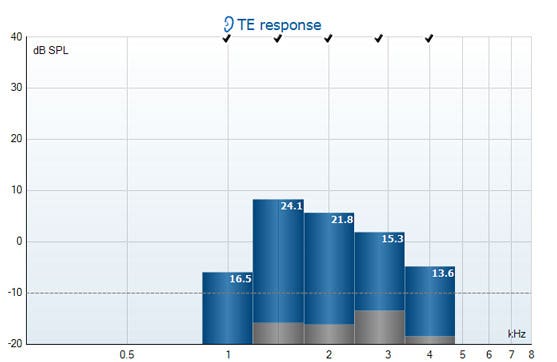 Five columns for the half-octave bands around 1, 1.5, 2, 3, and 4 kilohertz. All five bands have passed, with TEOAE response amplitudes ranging between minus 7 to plus 8 dB SPL, and signal-to-noise ratios ranging between 13.6 to 24.1.