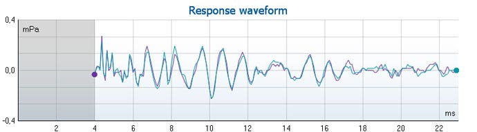 Graph with mPa as a function of milliseconds. The waveform ranges from 4 to 23 milliseconds in the time domain, and ranges from about minus 0.2 to plus 0.3 mPa.