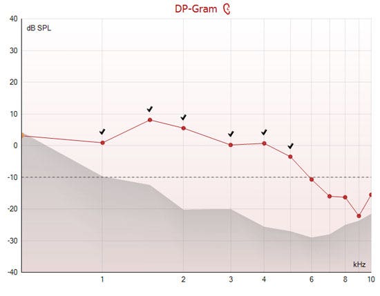 Graph with dB SPL as a function of kilohertz, titled as a DP-Gram. The noise floor is minus 10 dB SPL, and the noise amplitude is below this level from 1 to 10 kilohertz. The DP points at 6, 7, 8, 9, and 10 kilohertz are below the minimum OAE level of minus 10 dB SPL, and have thus not been accepted by the software.