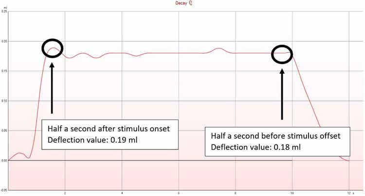 An acoustic reflex decay graph with a deflection value of 0,19 ml half a second after stimulus onset, and a deflection value of 0,18 ml half a second before stimulus offset.