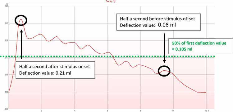 An acoustic reflex decay graph with a deflection value of 0,21 ml half a second after stimulus onset, and a deflection value of 0,06 ml half a second before stimulus offset. The 50% mark is 0,105 ml, indicated by green dotted lines.