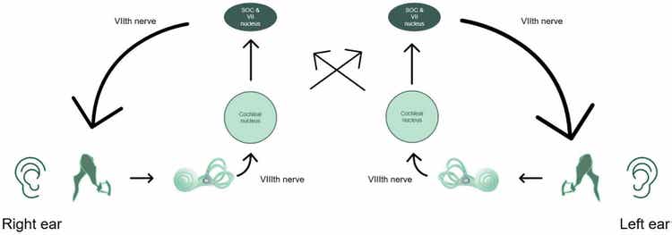 Acoustic reflex arc, shown as a pathway along the following: outer ear, middle ear, cochlea, eight cranial nerve, cochlear nucleus, facial motor nucleus, and the superior olivary complex.