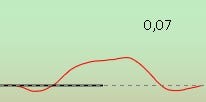 An upward-oriented, normal acoustic reflex with a deflection value of 0,07.