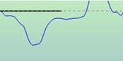 An acoustic reflex with a strange morphology that has both positive and negative peaks. Highlighted in green by the software to suggest that this is an acoustic reflex. However, it is an artifact.