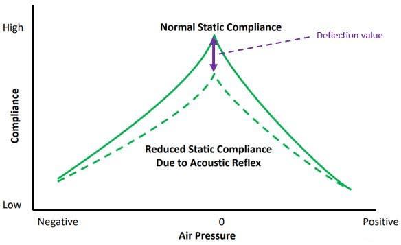 Two tympanograms in a graph where compliance is a function of air pressure. One of the tympanograms has a reduced static compliance due to the acoustic reflex, and this difference is called the deflection value.