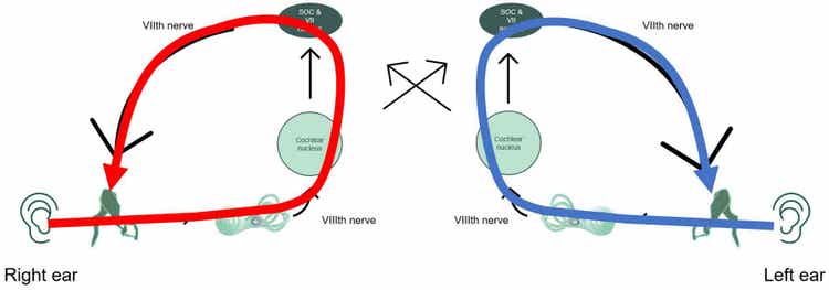 Ipsilateral reflex pathways shown with a red line through the acoustic reflex arc for the right ear, and with a blue line through the acoustic reflex arc for the left ear.