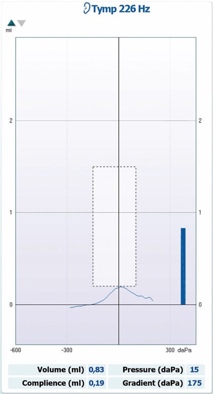 Ear canal volume of 0.83 ml, compliance of 0.19 ml, pressure of 15 daPa, and gradient of 175 daPa.