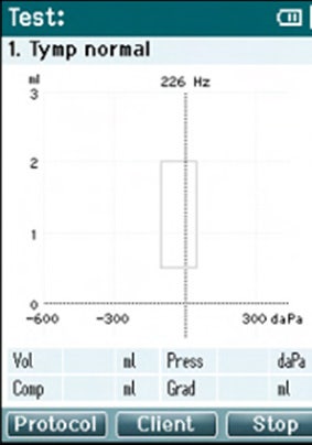 Empty tympanogram displayed on the interface of a handheld tympanometer. The graph has ml as a function of daPa. The normative data box ranges from about 0.5 to 2 ml and minus 100 to 50 daPa.