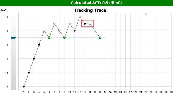 ACT test screen in the software. The patient has a calculated ACT value of 0 point 9 dB nCL. The graph has dB nCL as a function of presentations. The presentations at 16, 12, 8, and 4 dB nCL were all heard on the first try. Following, the patient scores correctly at 2 dB nCL two times, having been unable to hear below this level. However, the patient then goes on to supposedly hear the stimulus at 0 and minus 2 dB nCL. Suspecting a false response at minus 2 dB nCL, the clinician repeats the stimulus at this level. The patient fails to respond and ultimately scores correctly at 2 dB nCL for a third time.