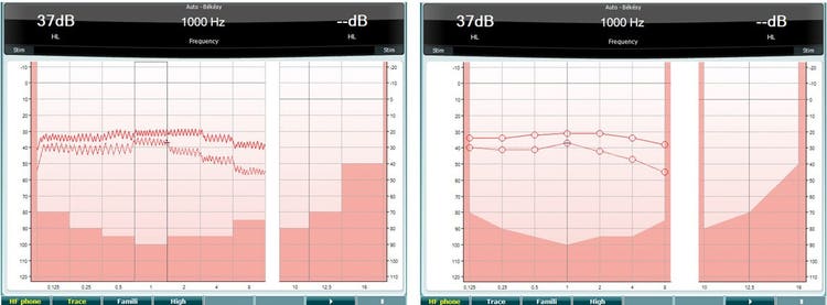 Two graphs with dB as a function of kHz. The tracing with the continuous tone is continuous, zig zagging up and down across all frequencies. The tracing with the pulsed tone is linear, showing responses for 0.125, 0.25, 0.5, 1, 2, 4, and 8 kHz.