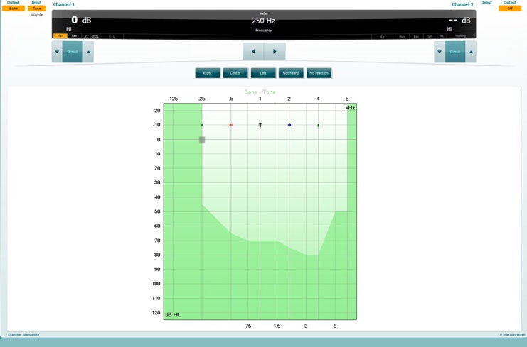 Below output, input, stimulus level, and stimulus presentation controls for channels 1 and 2, there is a graph with dB HL as a function of kHz. At each frequency, the patient has indicated whether they heard the tone better in the right or left ear, equal in both ears, or not heard at all.