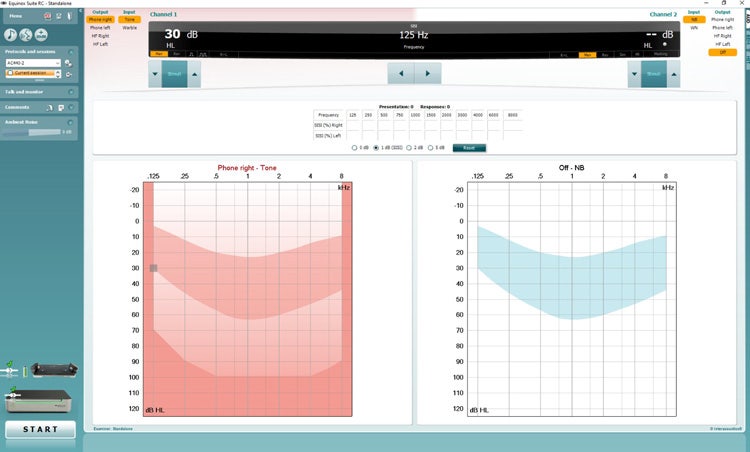 In addition to the ordinary controls for channels 1 and 2 and the audiograms, there is a table that shows the SISI percentage for the right and left ears for individual frequencies.