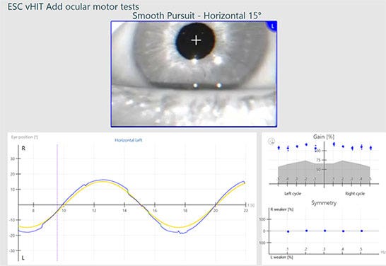 15-degree, horizontal smooth pursuit test overview for left eye. Normal values for eye position, gain and symmetry.