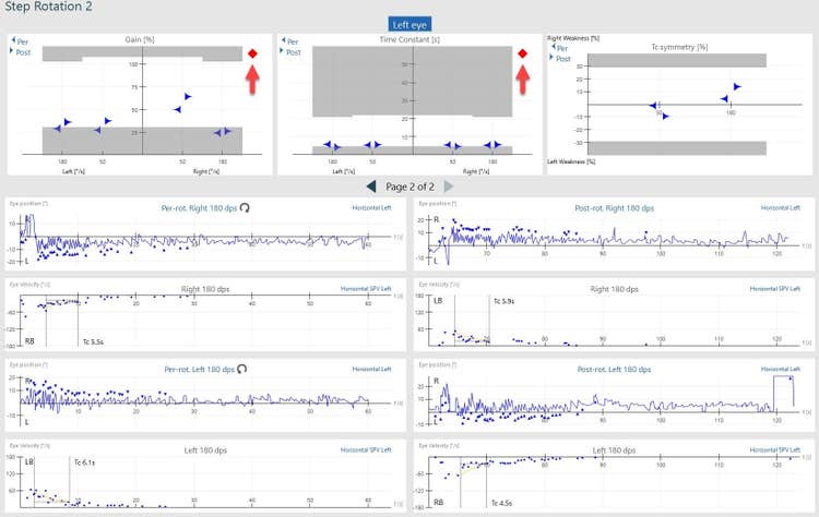 Velocity step test results screen, showing abnormal results for gain and time constant, visible by results placed in a grey shaded area.