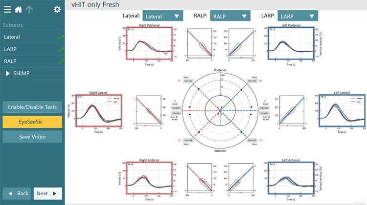 Results for left posterior, left lateral, left anterior, right anterior, right lateral, and right posterior.]