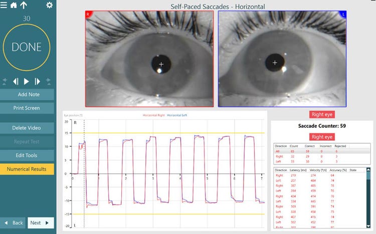 In this example, the saccade counter is displaying the results for the right eye. There are two data charts. The first has five columns which sum up the total amount of saccades when it comes to direction, count, correct, incorrect, and rejected. The second chart displays the results for each individual saccade, including direction, latency, velocity, and accuracy.