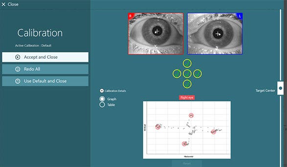 Completed eye calibration, visible by five green checkmarks in the up, left, down, right, and center positions. Three options are available to the left: accept and close, redo all, and use default and close.