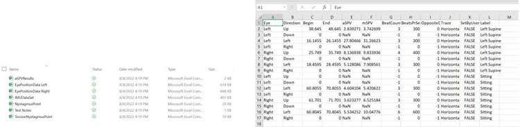 csv exports of average slow phase velocity results, eye position data, IMU data, nystagmus points, test notes, and torsional nystagmus points. An example of one of the spreadsheets is shown, with several columns containing various data, such as aSPV, direction, label, and others.