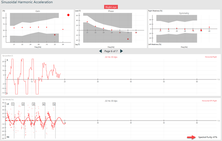 SHA results screen, with a red arrow showing where to find the spectral purity calculation. The spectral purity is 47%.