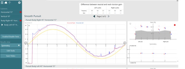 There are data and graphs for eye position, gain, symmetry, and the difference between neutral and neck torsion gain.