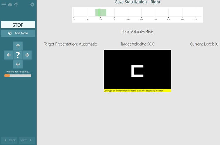 The target velocity is 50 degrees per second, with the acceptable green area lying between about 40 to 60. The patient has achieved a peak velocity of 46.6.