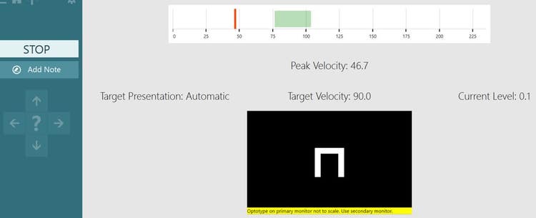 The target velocity is 90 degrees per second, with the acceptable green area lying between about 75 to 105. The patient has only achieved a peak velocity of 46.7.