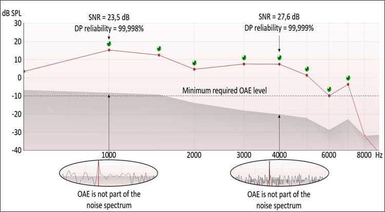 DPOAE response with a reliability of almost one hundred percent