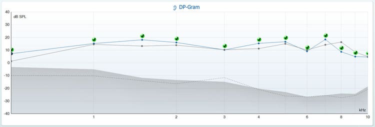 Overlaid DPOAE sessions in DP-gram